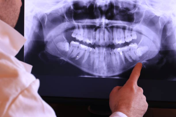 Best Emergency Dental Care for Broken or Chipped Teeth in Charlevoix, MI