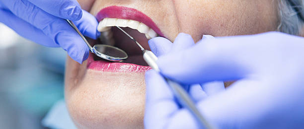 Best Emergency Gum Treatment in Charlevoix, MI