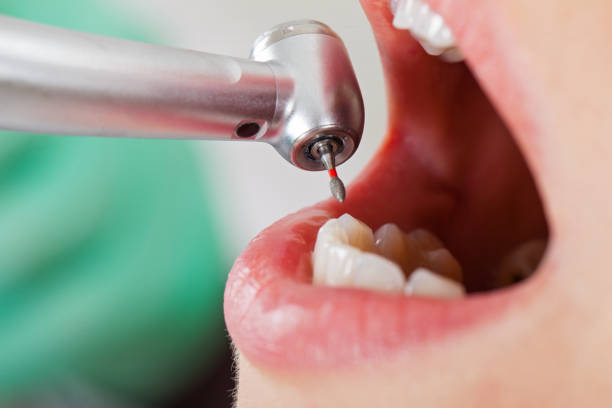 Best Emergency Denture Repair in Charlevoix, MI